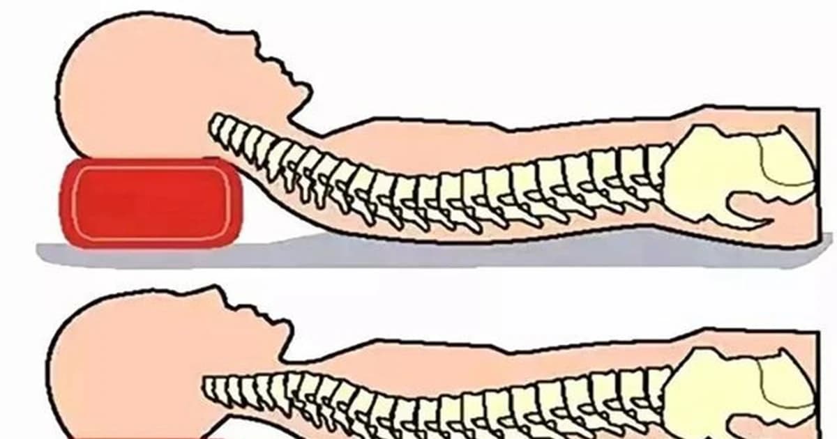 Ngủ với loại gối này, bạn sẽ gặp nhiều vấn đề sức khỏe