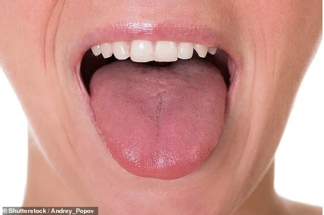 Lưỡi bạn tiết lộ điều gì về sức khỏe? Khoa học đã có câu trả lời