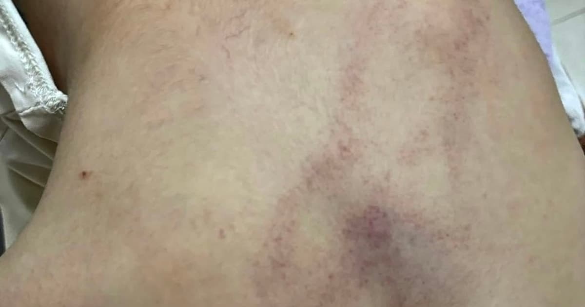 Hà Nội: Khẩn trương làm rõ vụ trẻ mầm non nghi bị bạo hành