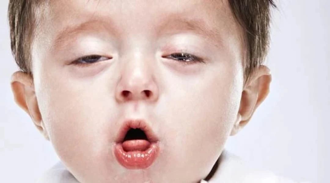 TPHCM ghi nhận ca đầu tiên mắc bệnh ho gà trong năm
