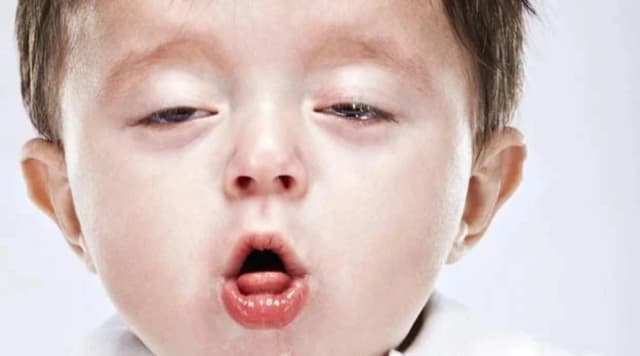 TPHCM ghi nhận ca đầu tiên mắc bệnh ho gà trong năm