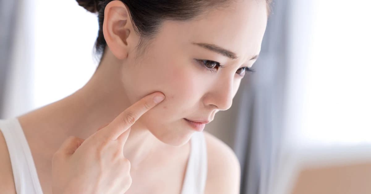 Bí quyết để có làn da trẻ mãi tuổi đôi mươi dù đã vượt ngưỡng 30+