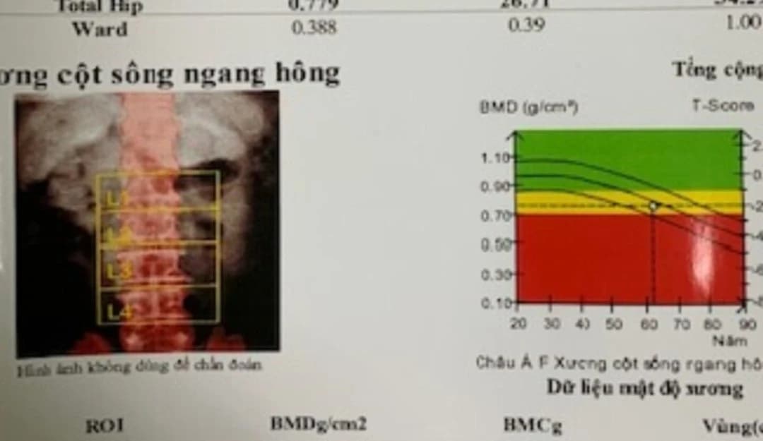 Kháng sinh đang bị dùng sai cách?