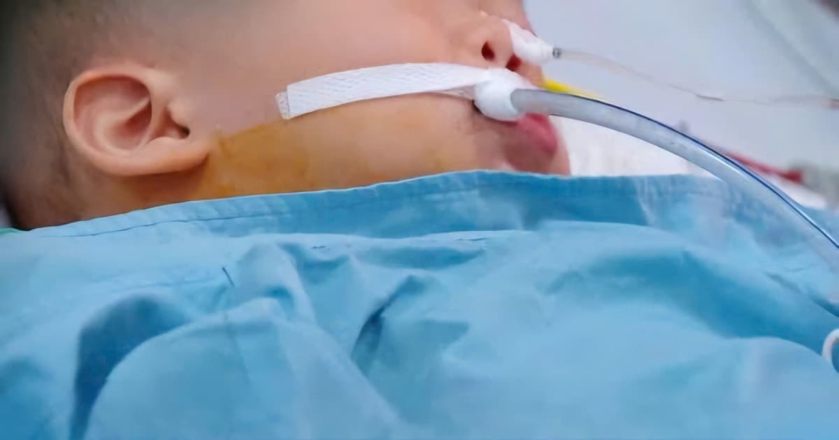 Bé trai 19 tháng tuổi nguy cơ di chứng vì ngộ độc hạt củ đậu