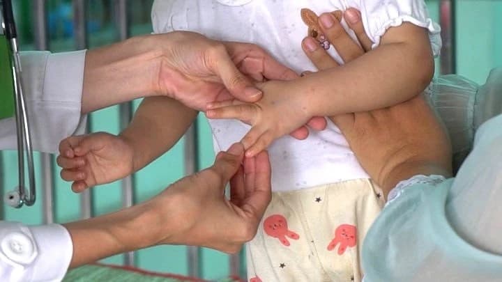 Bé 4 tuổi tử vong do tay chân miệng, Cần Thơ tăng cường giám sát dịch