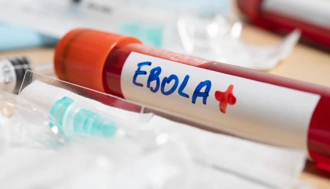 Hướng dẫn chẩn đoán và điều trị bệnh Ebola