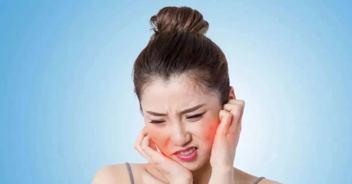 Cách xử lý da cháy nắng và chọn kem chống nắng an toàn