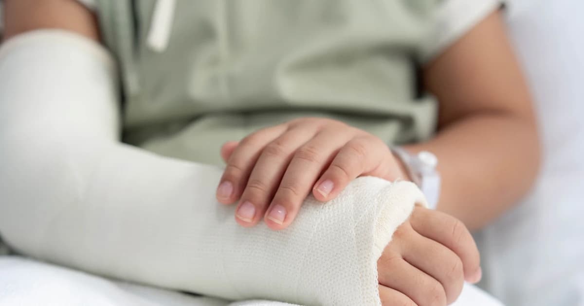 Gãy xương ở trẻ: Hiểm họa rình rập mùa Hè