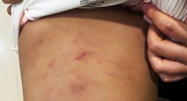 Tạm đình chỉ nhóm trẻ tư thục có trẻ bị bạo hành ở Cà Mau