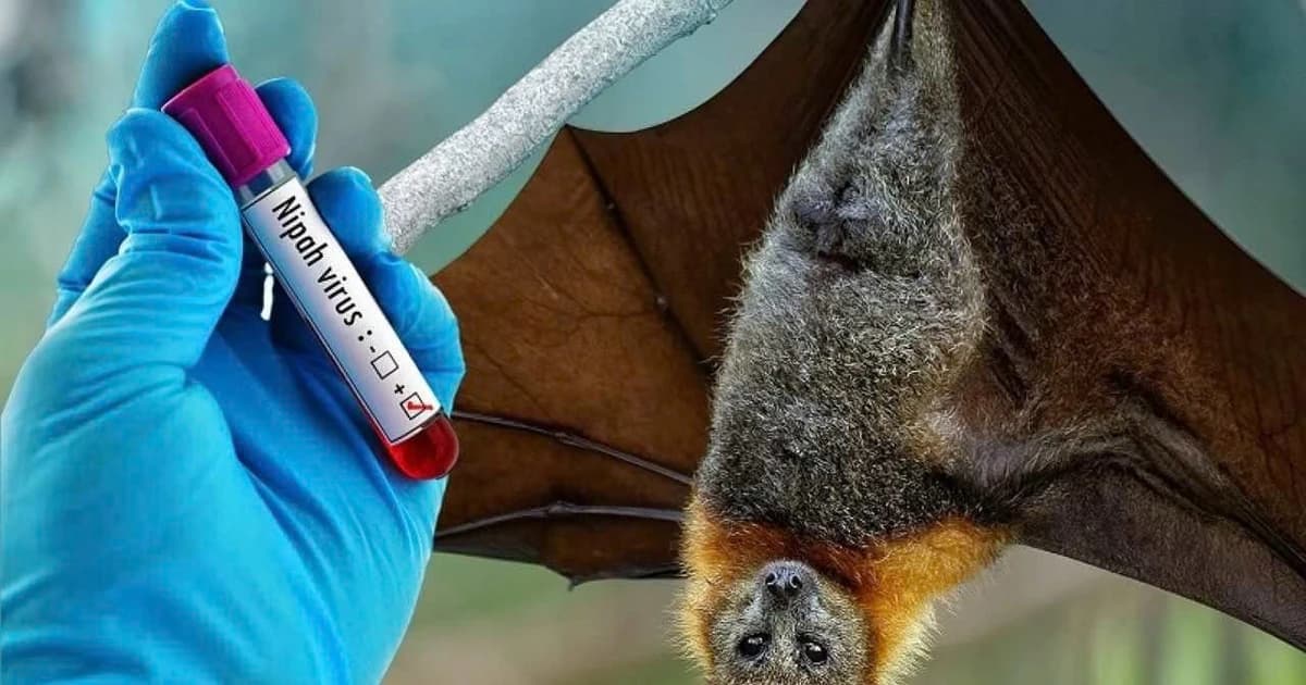 Nhận diện sớm nguy cơ nhiễm virus Nipah