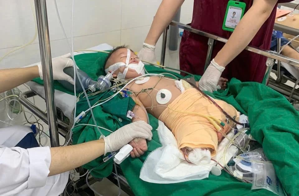 Đau xót hình ảnh bé trai 3 tuổi mất cả đôi chân sau biến cố kinh hoàng