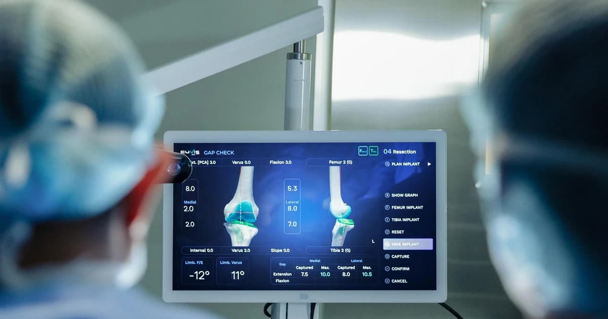 Việt Nam lần đầu có Robot AI thế hệ mới phẫu thuật thay khớp chủ động